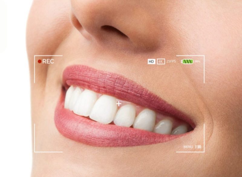 tay trang rang la gi